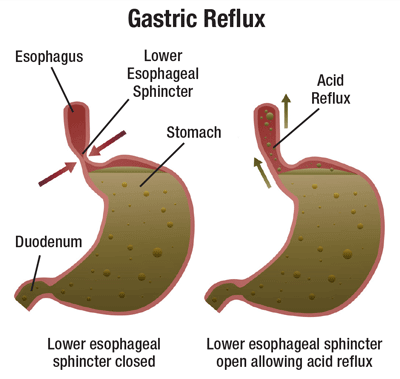 Oversigtstegning over mavesaekken