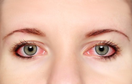 5-pink-eye