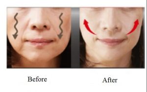 4 tips til at glatte og løfte hængende kinder