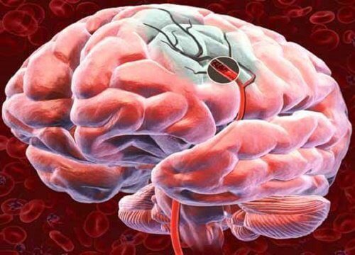 5 metoder til at øge blodtilførslen til hjernen