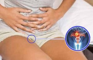 Har du livmoderhalskræft? Kig efter disse advarselstegn