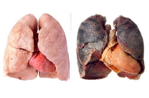 Sådan får du renere lunger
