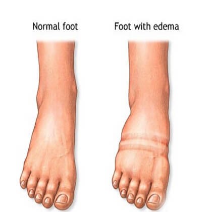 ØdemIFødder