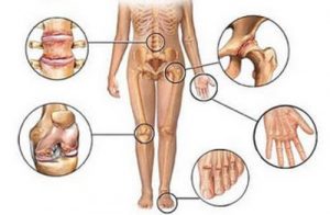 Ledsmerter: Fem naturlige antiinflammatoriske midler