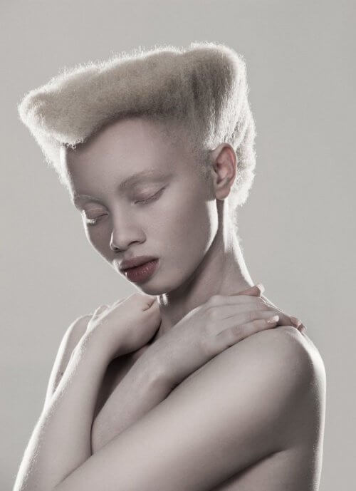 Albino-model