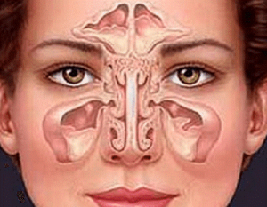 Sådan kan du afhjælpe bihulebetændelse