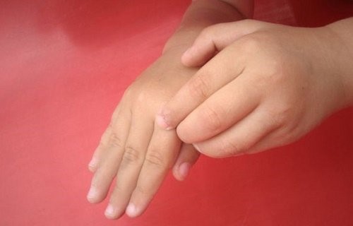 Det kan være rigtig ubehageligt, når ens hud klør