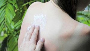 Sådan undgår du solskoldning og solskader