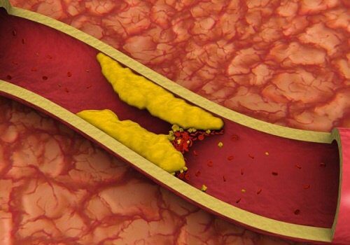 8 infusioner der sænker dit kolesterol