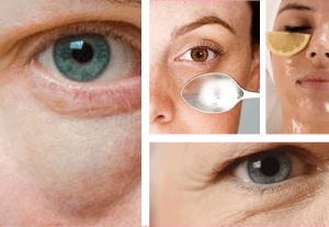 Enkle tips til at bekæmpe poser under øjnene