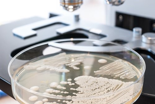 Petriskaal Candida