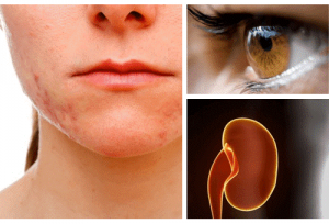 De mest beskadigede organer under stress