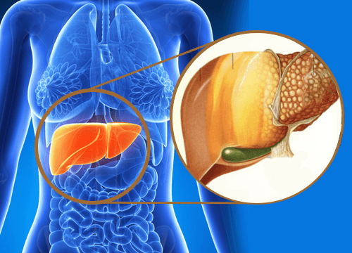 Hvad er hepatisk steatose? Hvordan behandles det?
