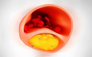 8 fødevarer der hjælper med at rense blodårerne