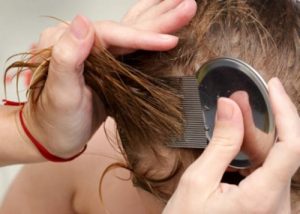 7 naturlige måder til hurtigt at slippe af med lus og luseæg