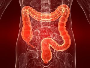 Colitis ulcerosa: Årsager, symptomer og behandling
