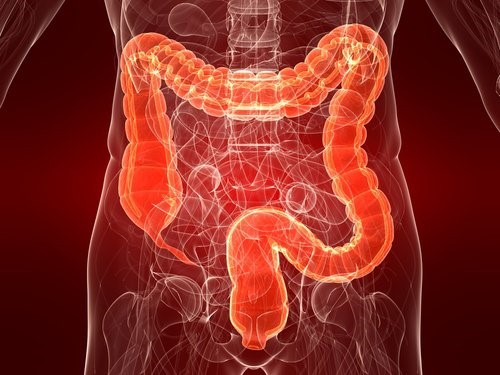Colitis ulcerosa: Årsager, symptomer og behandling
