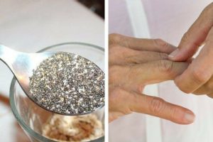 Sådan lindres symptomer på leddegigt