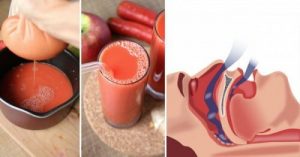 Naturligt middel mod snorken og søvnapnø