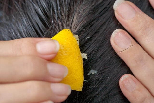 Brug citronsaft mod hårtab