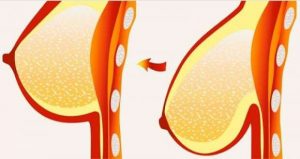 8 praktiske råd til at løfte hængebryster