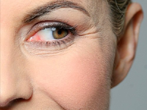 Ti fødevarer til bekæmpelse af rynker