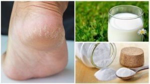 Skrub fødderne med kokosolie og salt