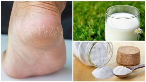 Blødere fødder med blot to naturlige ingredienser