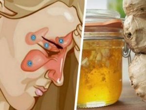 Sådan kan du lindre bihulebetændelse med kun to ingredienser