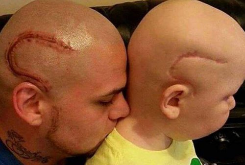 "Nu er vi ens." Far får tatoveret sønnens ar fra kræftoperation