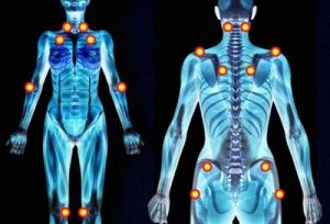 5 tidlige advarselstegn på fibromyalgi