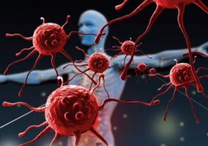 Ting der ødelægger dit immunforsvar