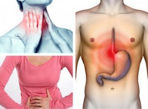 Lider du af gastroøsofageal reflukssygdom?