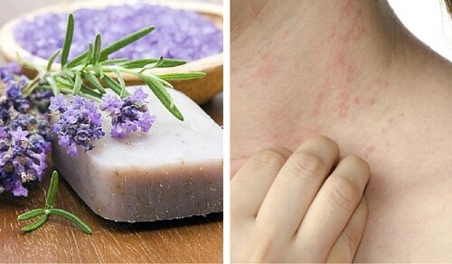 Særlig hjemmelavet sæbe til sart hud og dermatitis