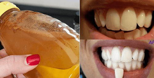 Bleg dine tænder med en 100% naturlig ingrediens