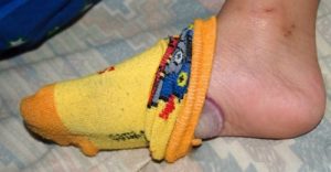 4 fordele ved at sove med løg på dine fødder