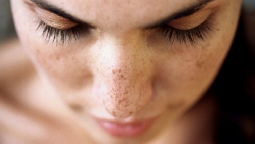 6 naturlige midler, der vil fjerne sorte pletter på dit ansigt