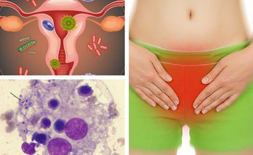 6 tips til at lindre vaginale infektioner