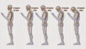 9 vaner der kan forårsage smerter i nakken