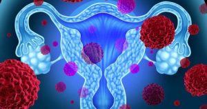 Toksisk shock syndrom og tamponer: Vær forsigtig!