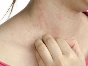 5 ukendte symptomer på diabetes