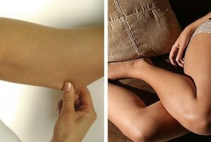 Ton dine arme og ben, så de bliver faste og flotte