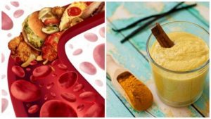 De 5 bedste ingredienser til at rense tilstoppede arterier