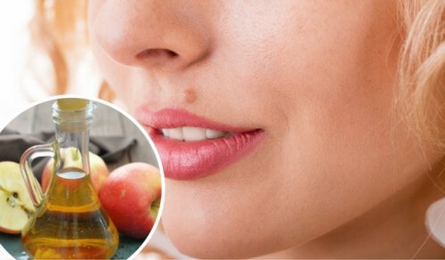 Sådan fjerner man skønhedspletter naturligt