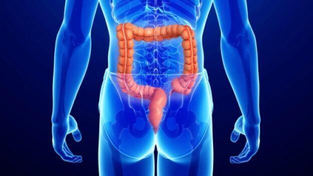 Analkræft sidder i enden af tyktarmen og viser sig bl.a. som vorter i det anale område