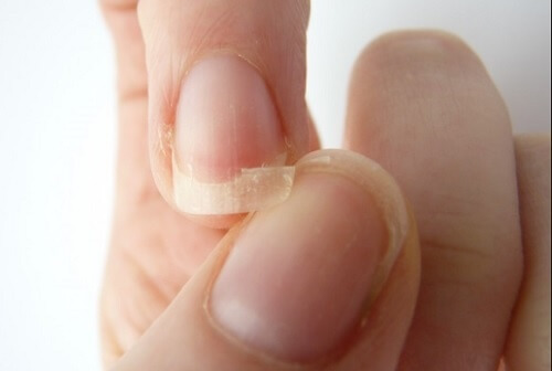 9 grunde til, at dine negle knækker