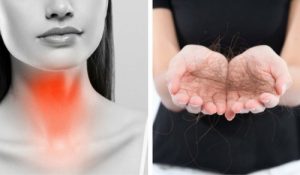 8 der kan bekæmpe skjoldbruskkirtelrelateret hårtab