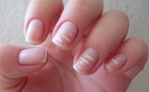 fingre