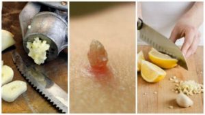 Slip af med vorter med denne hvidløg-citron behandling
