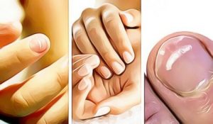 5 ting dine fingernegle siger om dit helbred
